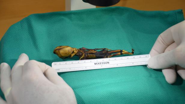 Rätsel gelöst: Mini-Mumie aus Chile ist kein Außerirdischer
