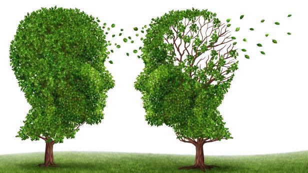 Alzheimer-Therapie: Neuer Ansatz gibt Hoffnung