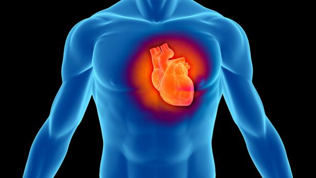 Herzschrittmacher sind eines der Implantate, wo es gravierende Fehler gegeben haben soll.