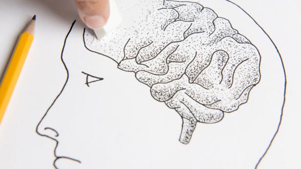 Untersuchung zeigt, dass ein Schädel-Hirn-Trauma zu Demenz führen kann