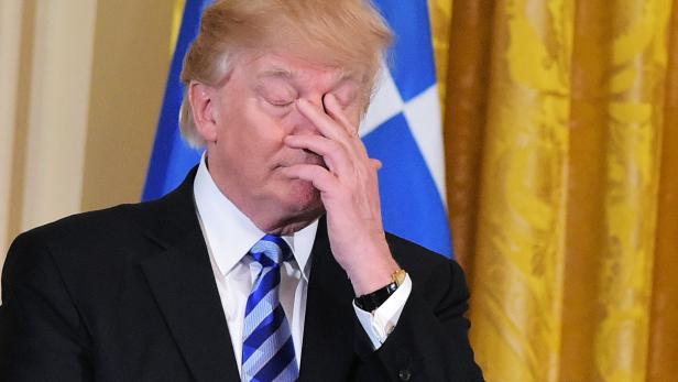 Donald Trump: Niederlagen tun weh.