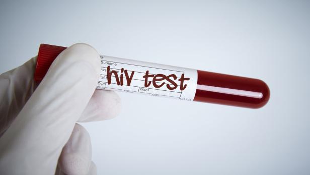 HIV-infiziert oder HIV-positiv zu sein bedeutet, dass eine Ansteckung mit dem HI-Virus vorliegt.