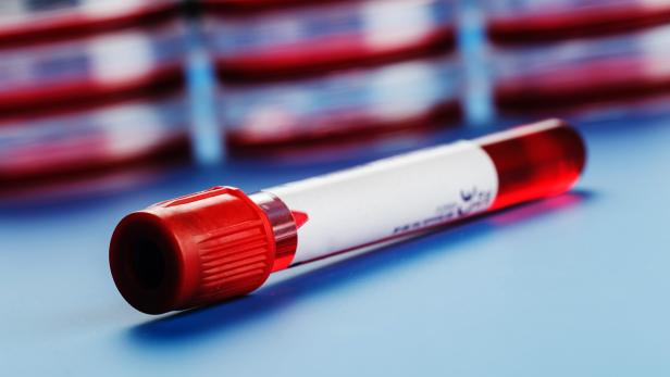 Blood sample in a tube on a blue table