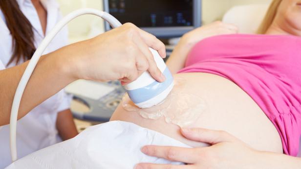 Eine schwangere Frau wird mit Ultraschall untersucht.