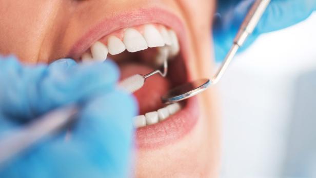 Die Krankenkassen haben gratis Zahnreinigung für Kinder und Jugendliche beschlossen
