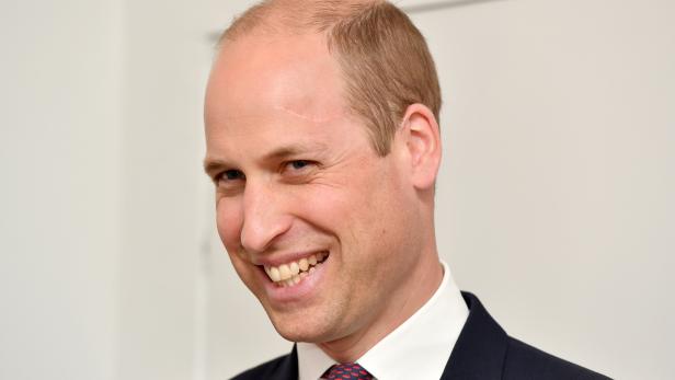 Prinz William: Woher die Narbe auf seiner Stirn stammt