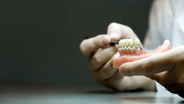 Nach OP: Zahnprothese steckte Patienten tagelang in Kehle fest