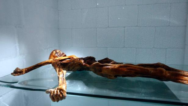 Analyse: Was uns Ötzis neueste Magen-Untersuchung lehrt