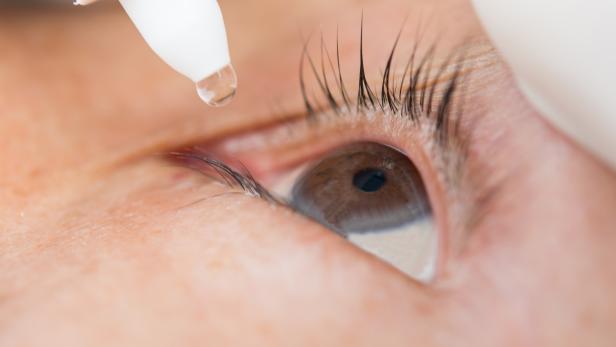 Conjunctivitis in the eye women