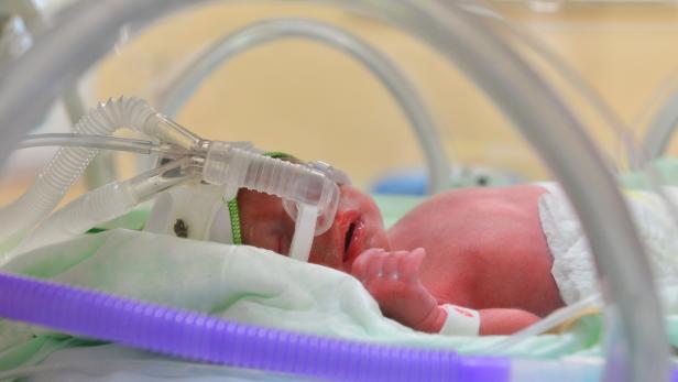 Verwirrung um Bettenzahl für Frühgeborene in Wiens Spitälern