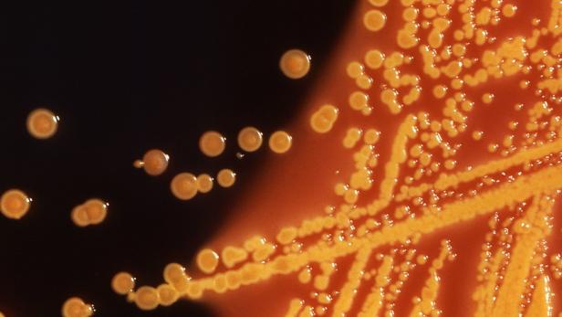 Antibiotikaresistente Bakterien unter dem Mikroskop