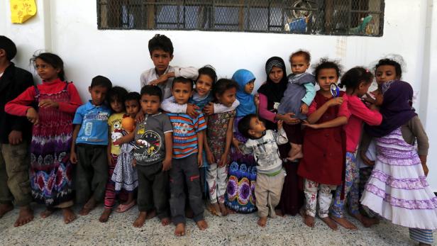 Millionen Jemeniten sind am Rande des Verhungerns, eine humanitäre Katastrophe ist in vollem Gang.