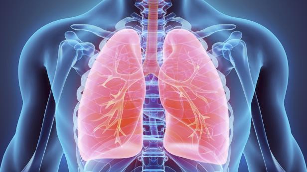 Wegen Covid-19 steigt die Zahl der Lungentransplantationen