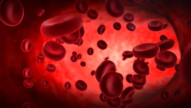 Cholesterin und Co.: Wenn hohe Blutfettwerte unerkannt bleiben