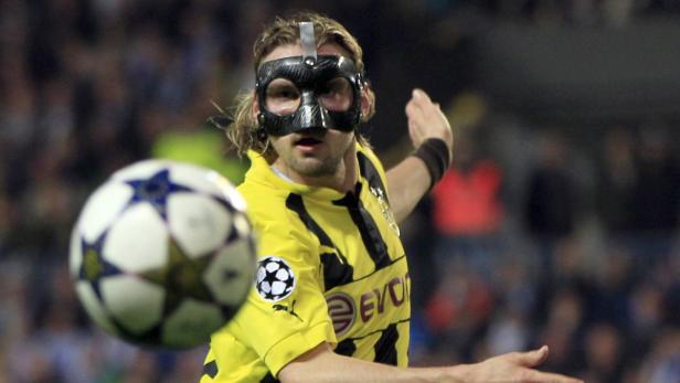 Ein Fußballspieler von Borussia Dortmund mit einer Schutzmaske am Kopf spielt einen Ball.