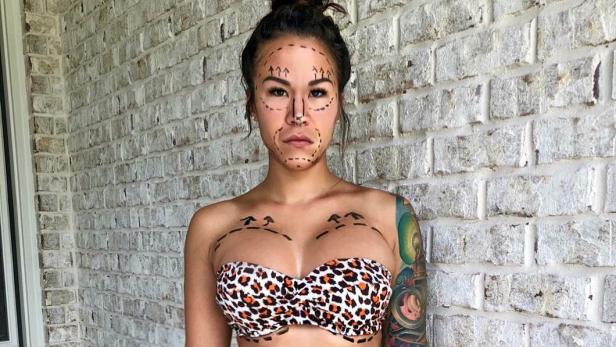 Virales Foto: Bloggerin zeigt, wie "degradierend" Beauty-OPs sind