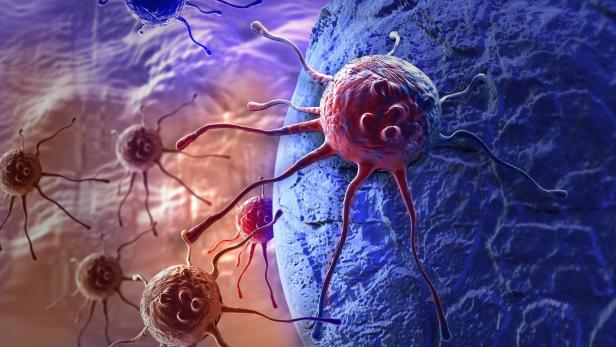 Neue Therapien helfen dem Abwehrsystem, Krebszellen besser zu erkennen.