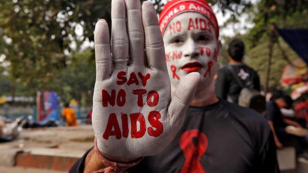 Der Sieg über die Immunschwächekrankheit Aids ist in Gefahr, warnt auch die UNO.