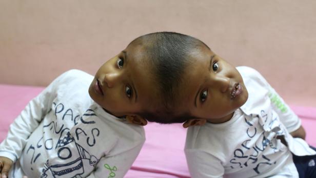 BANGLADESH-HEALTH-CHILDREN