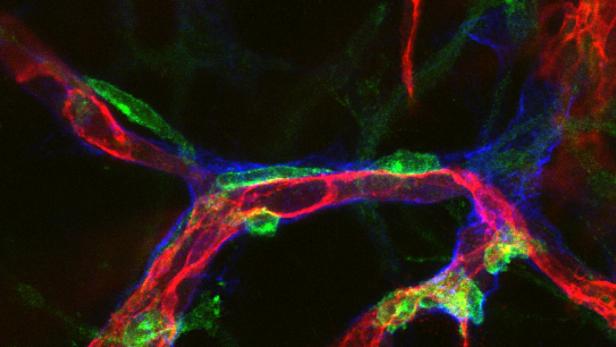 Visualisierung der Blutgefäße (rot), die aus Stammzellen entwickelt wurden.