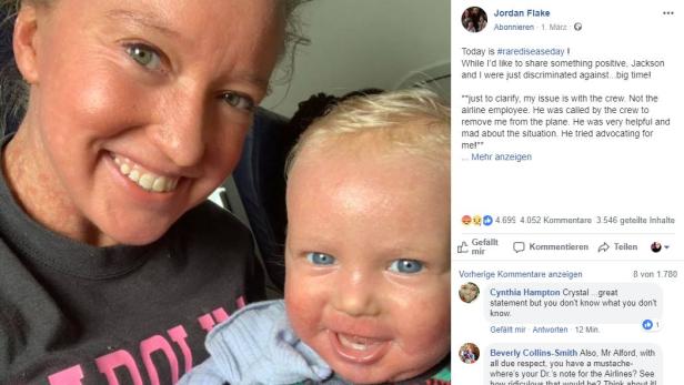 USA: Mutter und Baby wegen Hautkrankheit aus Flieger verwiesen