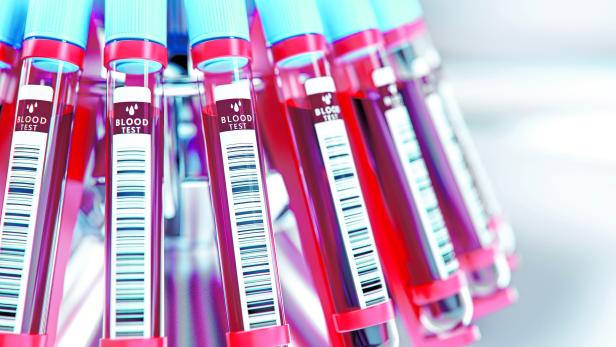 Lab equipment centrifuging blood. Concept image of a blood test.3d rendering.