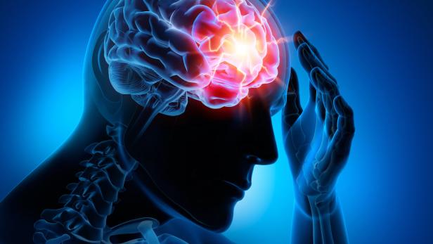 Epilepsie: Ein Implantat lässt Anfälle vorhersagen