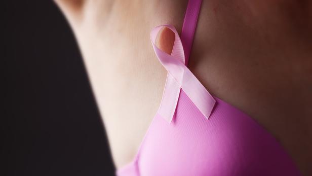 Brustkrebs bleibe nach Lungenkrebs die zweittödlichste Krebsart bei Frauen.