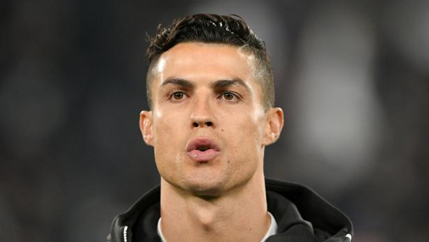 Cristiano Ronaldo sieht keine Transplantation auf sich zukommen