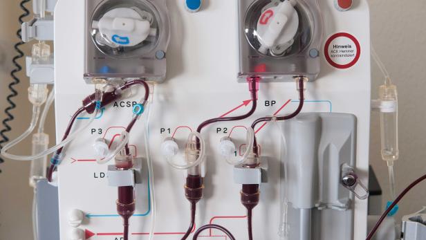 Eine Dialysemaschine mit Schläuchen und Pumpen im Detail.