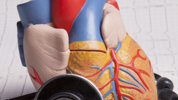 Forscher arbeiten an Methoden um Herzinfarkte bereits in sehr frühen Stadien zu erkennen.
