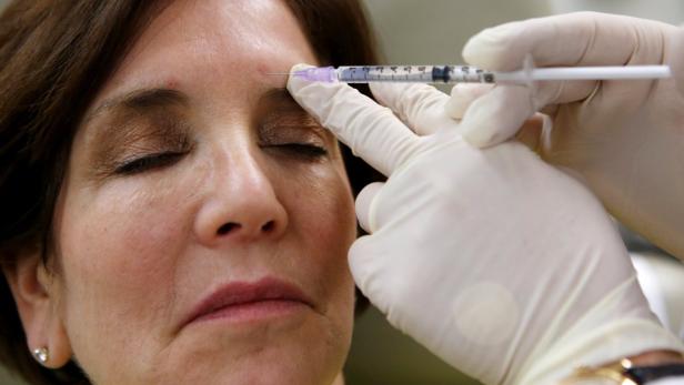 So kennt man Botox: als Wundermittel gegen Falten. Das Nervengift hemmt die Signalübertragung von Zellen, die Acetylcholin als Überträgerstoff verwenden. Dadurch kommt es zur Lähmung jenes Muskels, in den der Wirkstoff injiziert wird. Diese Wirkung macht sich die Medizin allerdings nicht nur für glatt gebügelte Haut im Gesicht zunutze.