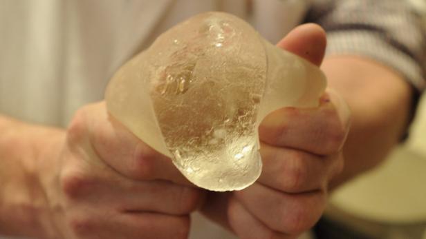 Eine Hand hält ein transparentes Kniemodell.