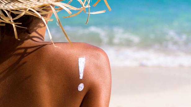 Sommer, Sonne, Sonnenbrand: In den heißen Monaten braucht die Haut besonders viel Schutzheißen.