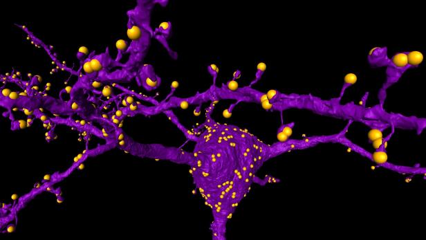 Eine Nervenzelle mit ihren verästelten Fortsätzen. Die gelben Kugeln sind die Synapsen, die Verbindungsstellen.