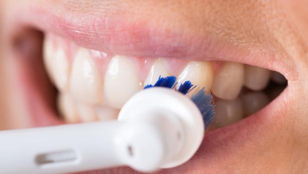Karies und Parodontitis: Was elektrische Zahnbürsten können