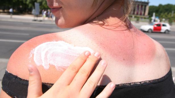 Vorsicht vor den UV-Strahlen im Sonnenlicht