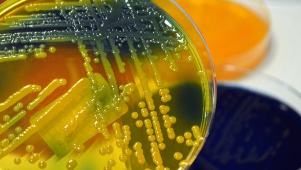 Bakterienkultur: Infektionen stehen am Beginn einer Sepsis.