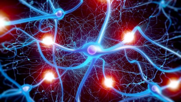 Bei Alzheimer gehen Nervenzellen langsam zugrunde.Verhindert werden kann das noch nicht.