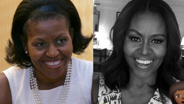 Beauty-Eingriffe? Verwandelte Michelle Obama
