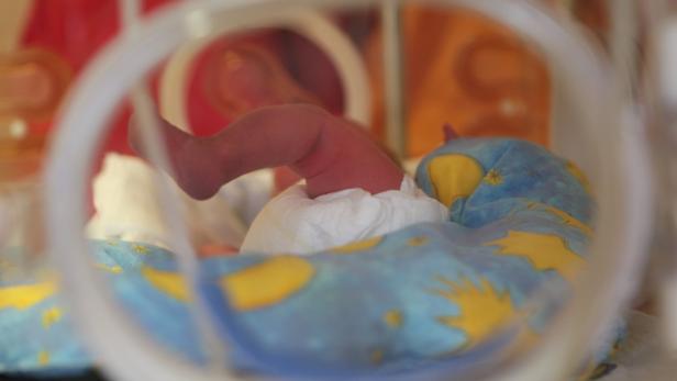 Auf der Neugeborenenstation des AKH Wien gibt es zwölf Intensivbetten für Frühchen wie dieses. Doch ein Drittel der Betten werden nicht verwendet, weil das Personal fehlt.