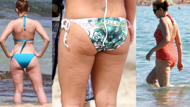 Nobody's perfect: Promis zeigen Cellulite