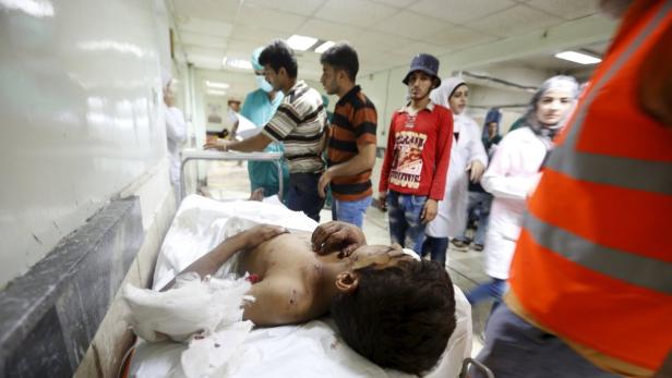 Ein verletzter Junge wird in einem syrischen Krankenhaus versorgt.