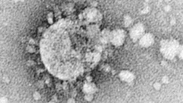 Ein Coronavirus unter dem Mikroskop