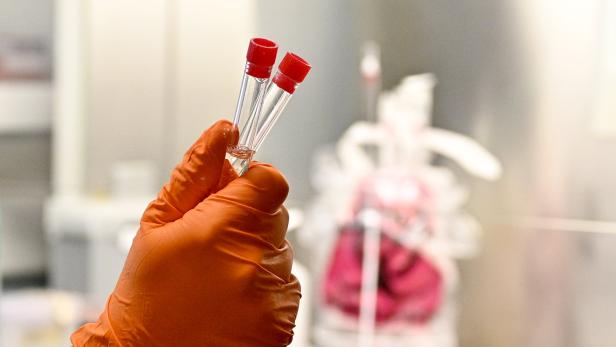 Laboruntersuchung zur Abklärung des Coronavirus aufgenommen am Inst. f. Hygiene u. Angewandte Immunologie am Mittwoch, 29. Jänner 2020, in Wien.