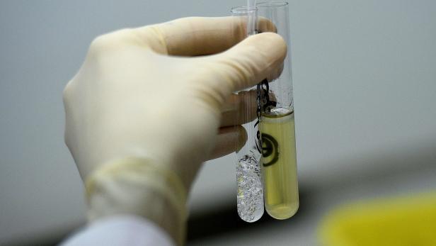 Wer sucht, der findet: Dopingfahndung im Labor