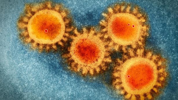 Coronavirus: Erbgutvarianten spiegeln Ausbreitung in Österreich wider