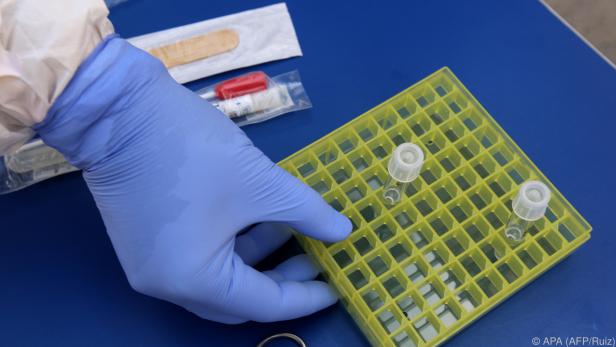 Verwendete PCR-Tests weisen keineswegs eine Aktivität der Viren nach
