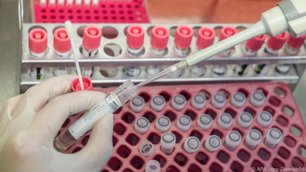 Durch PCR-Tests soll die Quarantäne der Pflegerinnen verkürzt werden