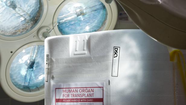 Ein Organbehälter für eine Transplantation unter einer Operationsleuchte.